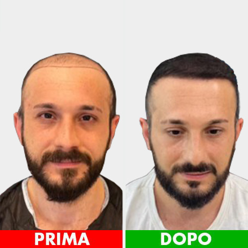 Caso4